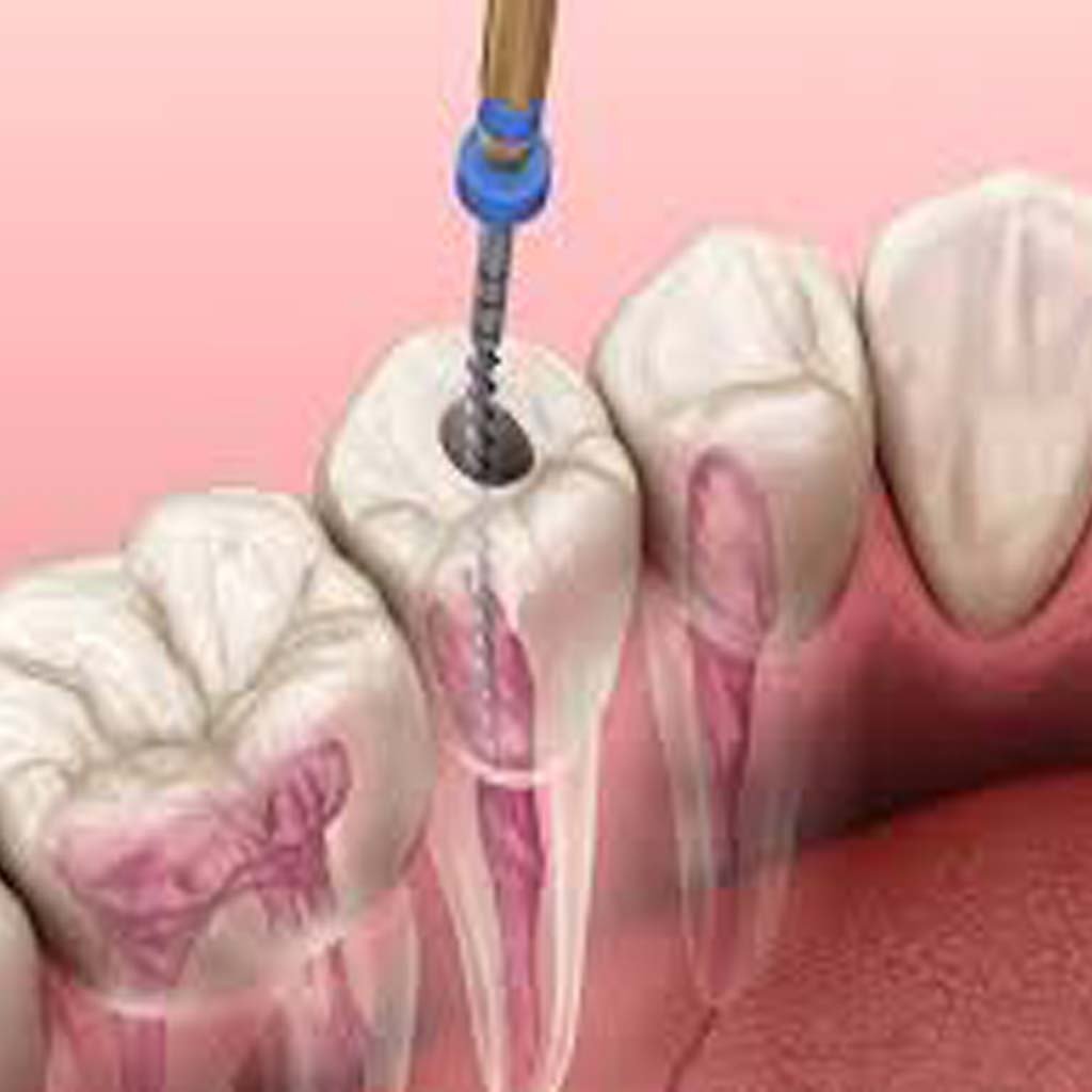 dental implant center in Dwarka Is Your Worst Enemy. 10 Ways To Defeat It